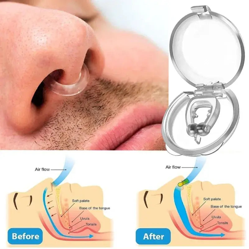 Peaceful Sleep Anti-Snoring Nose Clip
