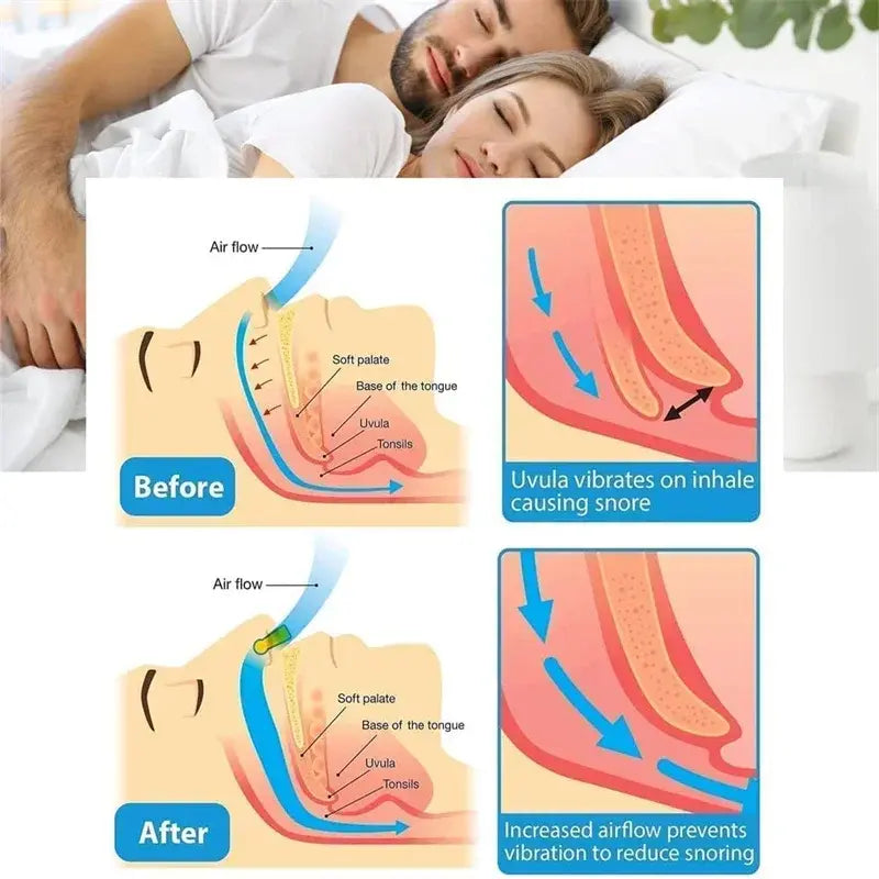 Peaceful Sleep Anti-Snoring Nose Clip